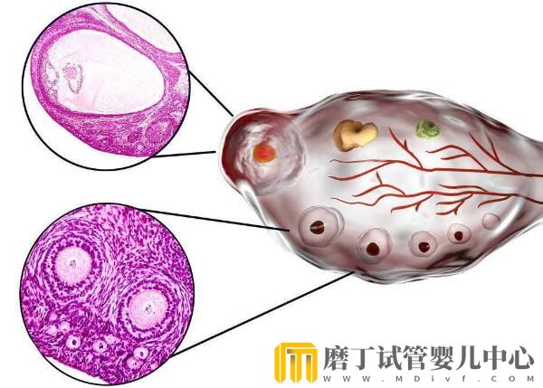 去老挝做试管婴儿过程痛苦吗？(图2)
