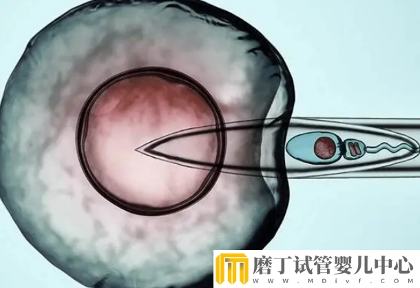 带囊肿肌瘤做试管成功案例分享，选择合适的促排方案很重要(图2)