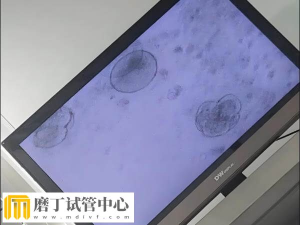 没达到冷冻标准的囊胚能否移植(图1)