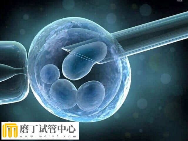 57岁试管生子案例有哪些(图1)
