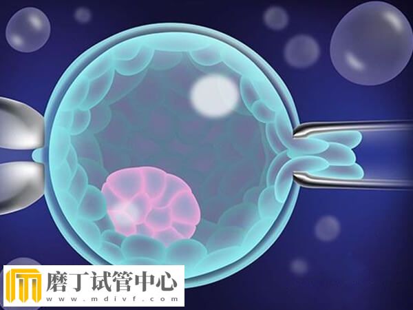 自然周期冻胚移植前要做什么检查(图1)