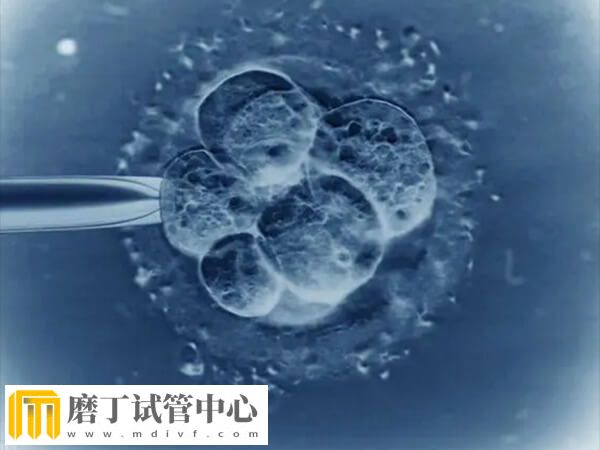 试管婴儿的各种方案有哪些(图2) 试管婴儿的各种方案有哪些(图2)